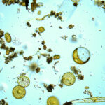 Microscopic image of phytoplankton