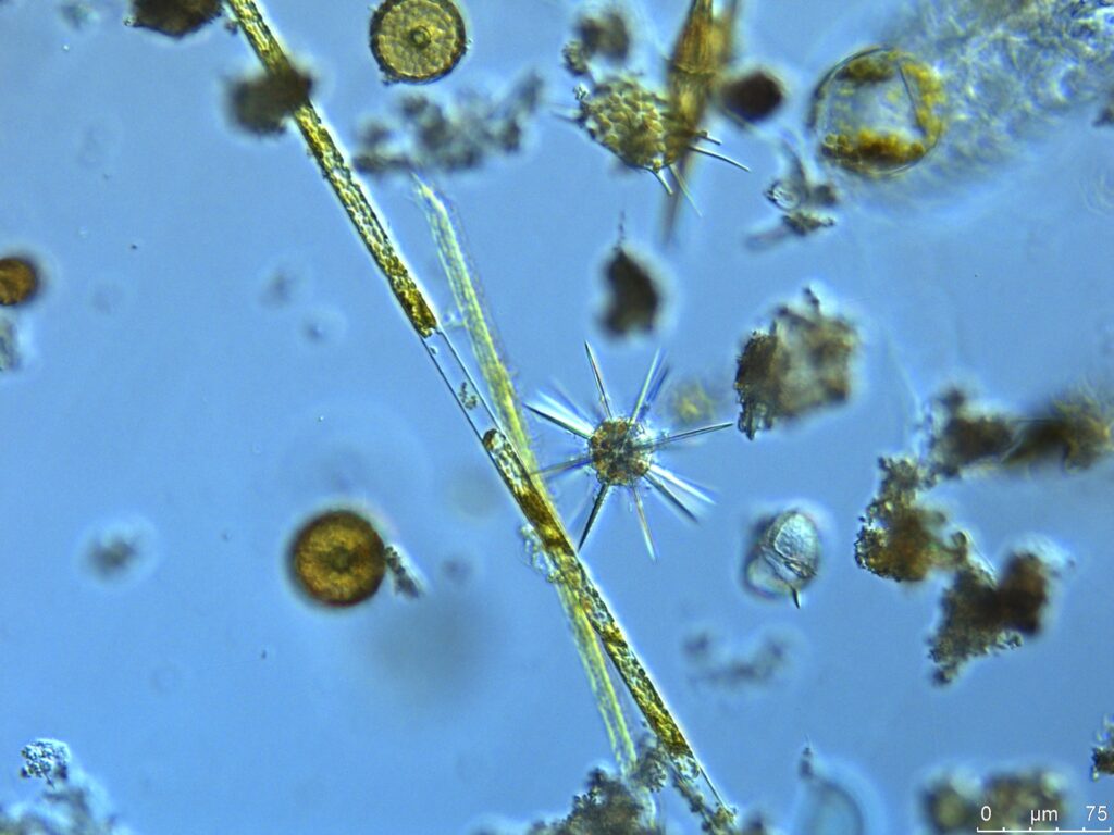 Phytoplankton viewed closely under a microscope, tiny creatures that look like stars, line, circles.