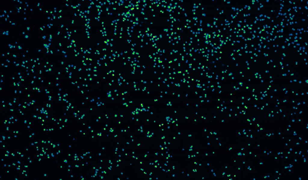 Chlorophyll fluorescence image of much smaller marine phytoplankton, coccolithophores.