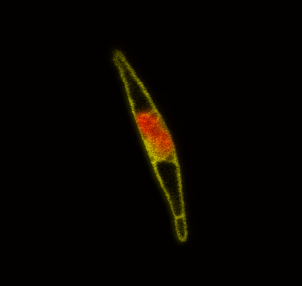 Diatom under a microscope against a black background, with yellow outer lines and a yellow and orange centre.