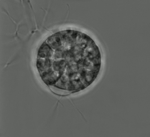 Chytrid cell under the microscope.