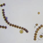 Alexandrium catenella. (c) Sarka Martinez
