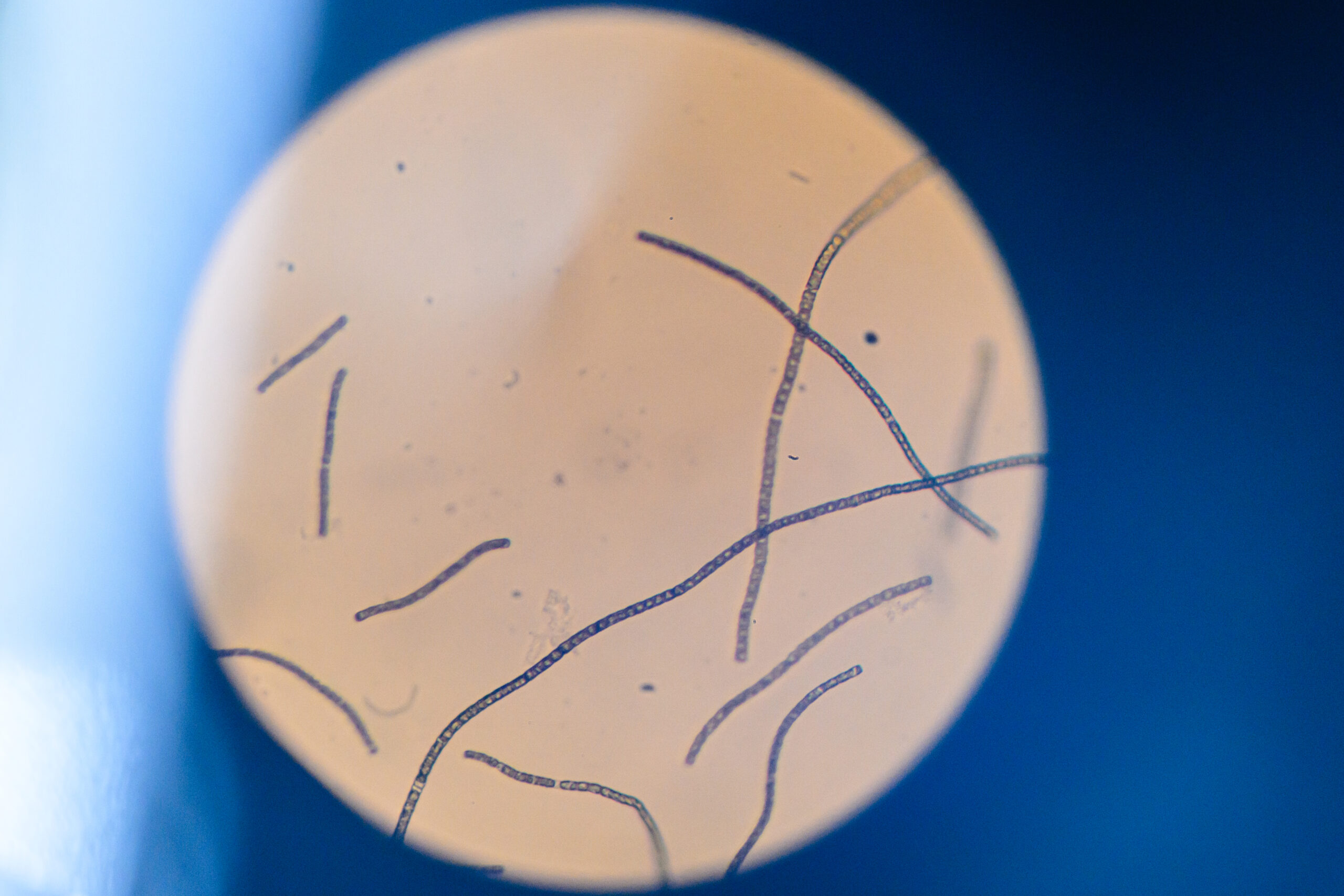 Hundred Diatom Genome Project microscope close up